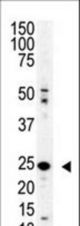 Western blot of SENP8 polyclonal antibody in mouse spleen lysate. SENP8 (arrow) was detected using purified antibody. Secondary HRP-anti-rabbit was used for signal visualization with chemiluminescence.