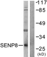 Western blot of extracts from HUVEC cells, using SENP8 Antibody. The lane on the right is treated with the synthesized peptide.