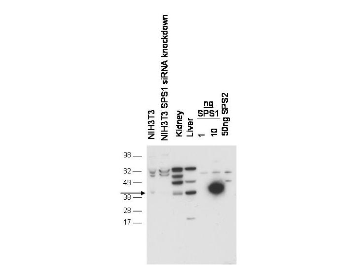 Anti-SPS1 Antibody - Western Blot. Western blot of anti-SPS1 antibody shows detection of endogenous SPS1 in NIH3T3 cell. No signal is seen in lysates from cells after pre-treatment with SPS1 siRNA. Endogenous SPS1 can be detected in mouse kidney and liver tissue lysates. Negligible cross-reactivity is seen against recombinant SPS2. The primary antibody was used at a 1:1000 dilution. Personal Communication, D. Hatfield, NCI, Bethesda, MD.