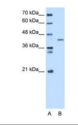 Lane A: Marker. Lane B: HepG2 cell lysate. Antibody concentration: 5.0 ug/ml. Gel concentration: 12%.