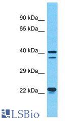 SEPHS1 / SPS antibody Western Blot of RPMI-8226. Antibody dilution: 1 ug/ml.