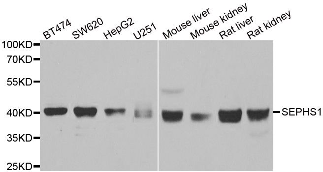 Western blot analysis of extracts of various cell lines, using SEPHS1 antibody.