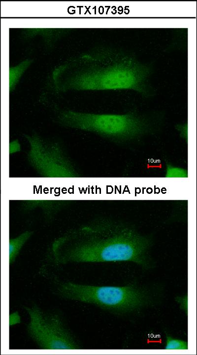 Immunofluorescence of paraformaldehyde-fixed HeLa using Selenophosphate synthetase 1 antibody at 1:200 dilution.