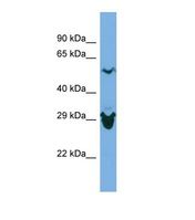 Western blot of Human ACHN. SEPHS2 antibody dilution 1.0 ug/ml.