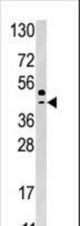 Western blot of anti-SEPSH2 Pabin HepG2 cell line lysate (35 ug/lane). SEPSH2(arrow) was detected using the purified antibody.