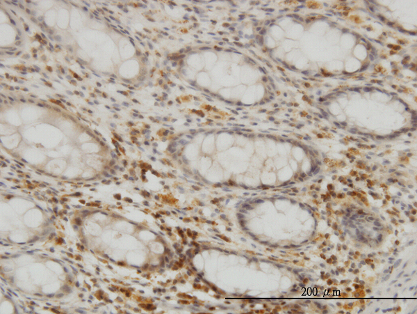 Immunoperoxidase of monoclonal antibody to SEPHS2 on formalin-fixed paraffin-embedded human colon. [antibody concentration 3 ug/ml]