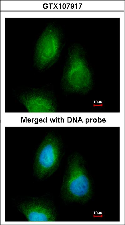 Immunofluorescence of paraformaldehyde-fixed HeLa using SEPHS2 antibody at 1:200 dilution.