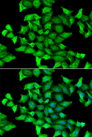 Immunofluorescence analysis of HeLa cell using SEPSECS antibody. Blue: DAPI for nuclear staining.