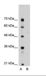 A: Marker, B: Jurkat Cell Lysate