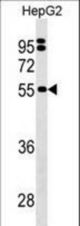SEPSECS Antibody western blot of HepG2 cell line lysates (35 ug/lane). The SEPSECS Antibody detected the SEPSECS protein (arrow).