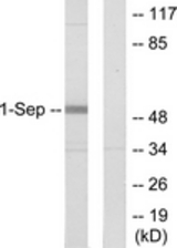 Western blot of extracts from Jurkat cells, using SEPT1 Antibody. The lane on the right is treated with the synthesized peptide.