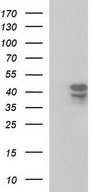 HEK293T cells were transfected with the pCMV6-ENTRY control (Left lane) or pCMV6-ENTRY SEPT1 (Right lane) cDNA for 48 hrs and lysed. Equivalent amounts of cell lysates (5 ug per lane) were separated by SDS-PAGE and immunoblotted with anti-SEPT1.