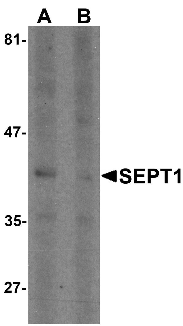 Western blot analysis of SEPT1 in Raji cell lysate with SEPT1 antibody at 1 ug/ml in (A) the absence and (B) the presence of blocking peptide.