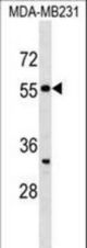 SEPT10 Antibody western blot of MDA-MB231 cell line lysates (35 ug/lane). The SEPT10 antibody detected the SEPT10 protein (arrow).