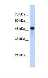 Jurkat cell lysate. Antibody concentration: 1.25 ug/ml. Gel concentration: 12%.