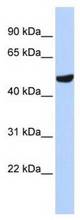 Western analysis of MCF7 cell lysate.