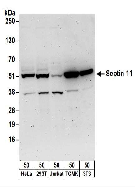 Detection of Human and Mouse Septin 11 by Western Blot. Samples: Whole cell lysate (50 ug) from HeLa, 293T, Jurkat, mouse TCMK-1, and mouse NIH3T3 cells. Antibodies: Affinity purified rabbit anti-Septin 11 antibody used for WB at 0.2 ug/ml. Detection: Chemiluminescence with an exposure time of 3 minutes.