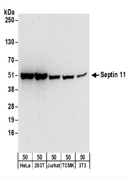 Detection of Human and Mouse Septin 11 by Western Blot. Samples: Whole cell lysate (50 ug) from HeLa, 293T, Jurkat, mouse TCMK-1, and mouse NIH3T3 cells. Antibodies: Affinity purified rabbit anti-Septin 11 antibody used for WB at 0.1 ug/ml. Detection: Chemiluminescence with an exposure time of 30 seconds.