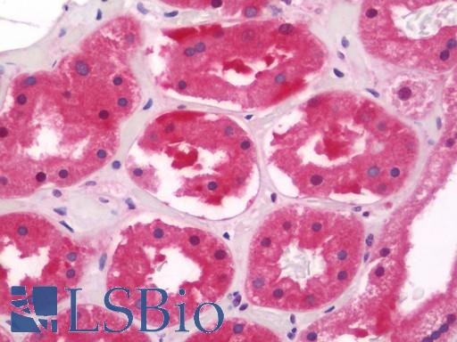 Anti-PSMD11 antibody IHC staining of human kidney. Immunohistochemistry of formalin-fixed, paraffin-embedded tissue after heat-induced antigen retrieval. Antibody LS-B11384 concentration 20 ug/ml.