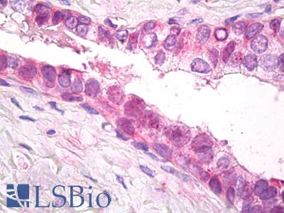 Anti-PSMD11 antibody IHC of human prostate. Immunohistochemistry of formalin-fixed, paraffin-embedded tissue after heat-induced antigen retrieval. Antibody LS-B7777 dilution 10 ug/ml.