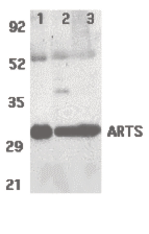 Western blot of ARTS expression in human lung (lane 1), spleen (lane 2), and kidney (lane 3) tissue lysates with ARTS antibody at 2 ug /ml.