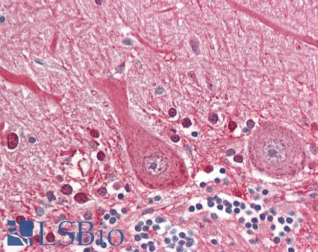 Anti-SEPT4 / Septin-4 antibody IHC of human brain, cerebellum. Immunohistochemistry of formalin-fixed, paraffin-embedded tissue after heat-induced antigen retrieval. Antibody LS-B8346 dilution 3.75 ug/ml.