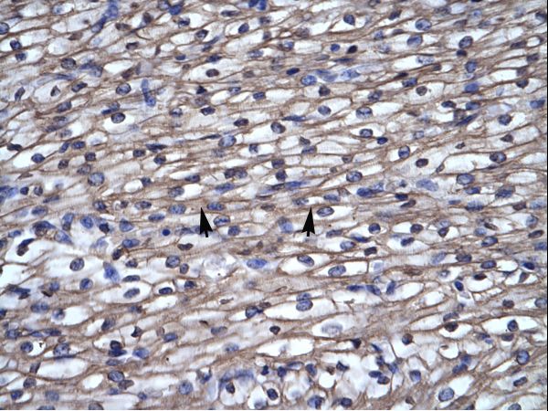 SEPT4 / Septin 4 antibody LS-C29924 was used in IHC to stain formalin-fixed, paraffin-embedded human heart.