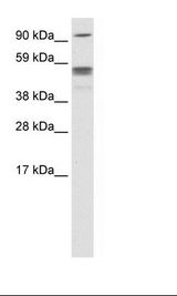 Fetal Cerebellum Lysate