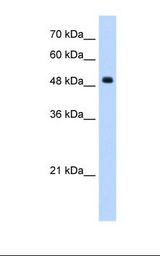 HepG2 cell lysate. Antibody concentration: 1.25 ug/ml. Gel concentration: 12%.