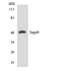 Western blot of the lysates from HeLa cells using SEPT6 antibody.