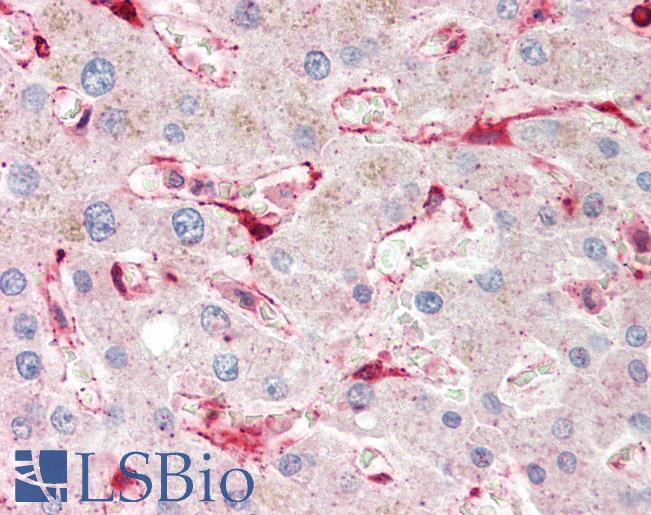 Human Liver: Formalin-Fixed, Paraffin-Embedded (FFPE)