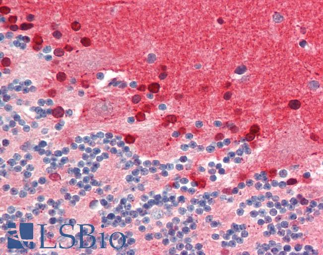 Human Brain, Cerebellum: Formalin-Fixed, Paraffin-Embedded (FFPE)