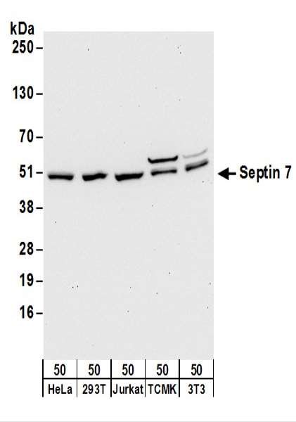 Detection of Human and Mouse Septin 7 by Western Blot. Samples: Whole cell lysate (50 ug) from HeLa, 293T, Jurkat, mouse TCMK-1, and mouse NIH3T3 cells. Antibodies: Affinity purified rabbit anti-Septin 7 antibody used for WB at 0.1 ug/ml. Detection: Chemiluminescence with an exposure time of 30 seconds.