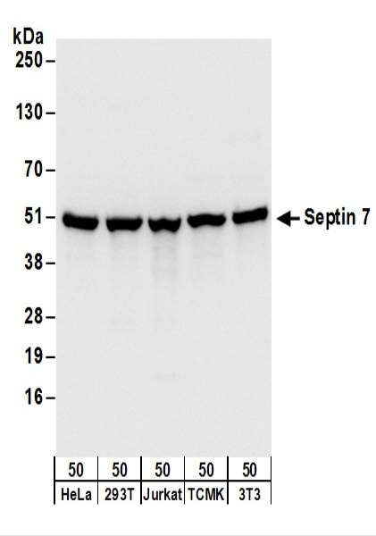 Detection of Human and Mouse Septin 7 by Western Blot. Samples: Whole cell lysate (50 ug) from HeLa, 293T, Jurkat, mouse TCMK-1, and mouse NIH3T3 cells. Antibodies: Affinity purified rabbit anti-Septin 7 antibody used for WB at 0.1 ug/ml. Detection: Chemiluminescence with an exposure time of 1 second.