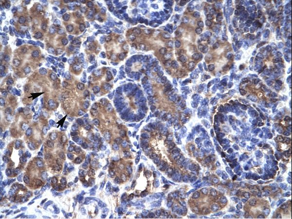 PSMD11 antibody LS-C31009 was used in IHC to stain formalin-fixed, paraffin-embedded human kidney.