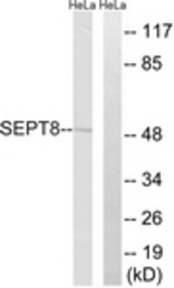 Western blot of extracts from HeLa cells, using SEPT8 Antibody. The lane on the right is treated with the synthesized peptide.