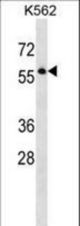 SEPT8 Antibody western blot of K562 cell line lysates (35 ug/lane). The SEPT8 antibody detected the SEPT8 protein (arrow).