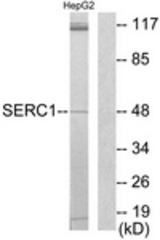 Western blot of extracts from HepG2 cells, using SERC1 Antibody. The lane on the right is treated with the synthesized peptide.