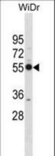 PSMD12 Antibody western blot of WiDr cell line lysates (35 ug/lane). The PSMD12 antibody detected the PSMD12 protein (arrow).