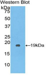 Western blot of recombinant SERPINA10 / PZI.
