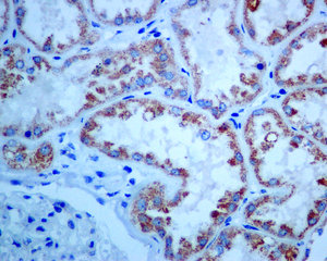 IHC of paraffin-embedded human kidney tissue using anti-PSMD13 antibody.