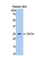 Western blot of recombinant SERPINA10 / PZI.