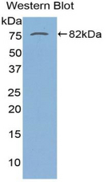 Western blot of recombinant SERPINA10 / PZI.