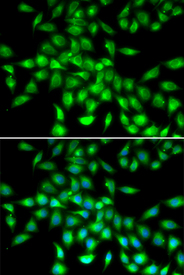 Immunofluorescence blot of A549 cell using SERPINA10 antibody. Blue: DAPI for nuclear staining.