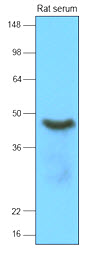 Rat serum (15 ug) was resolved by SDS-PAGE, transferred to NC membrane and probed with anti-human Vaspin (1:2000). Proteins were visualized using a goat anti-mouse secondary antibody conjugated to HRP and an ECL detection system.