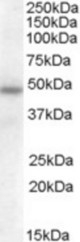 Antibody (0.5 ug/ml) staining of Human Adipose lysate (35 ug protein in RIPA buffer). Primary incubation was 1 hour. Detected by chemiluminescence