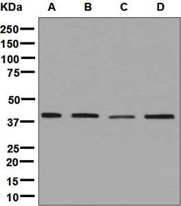 Western blot analysis on (A) Y79, (B) HeLa, (C) HepG2, and (D) Jurkat cell lysates using anti-PSMD13 antibody.