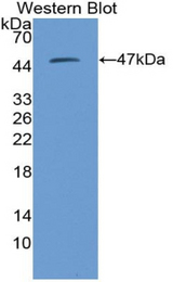 Western blot of recombinant PSMD13.