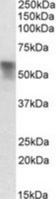 SERPINA6 antibody (0.03 ug/ml) staining of Rat Liver lysate (35 ug protein/ml in RIPA buffer). Primary incubation was 1 hour. Detected by chemiluminescence.