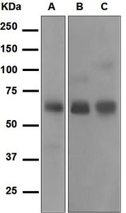Western blot analysis on (A) fetal artery, (B) human plasma, and (C) human placenta lysates using anti-Serpin A6 antibody.
